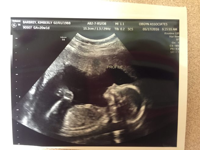 Girl US Official Ultrasound